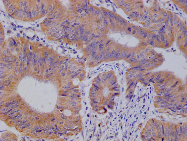 GLUT3 Antibody in Immunohistochemistry (Paraffin) (IHC (P))