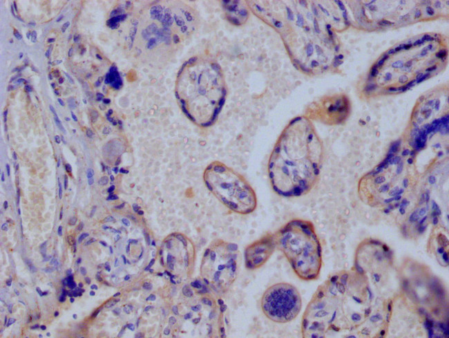 GLUT3 Antibody in Immunohistochemistry (Paraffin) (IHC (P))