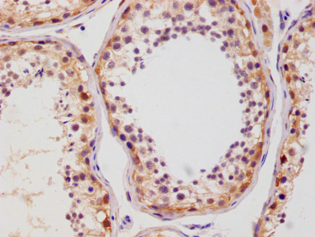 GLUT3 Antibody in Immunohistochemistry (Paraffin) (IHC (P))