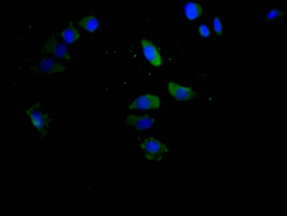 CD147 Antibody in Immunocytochemistry (ICC/IF)