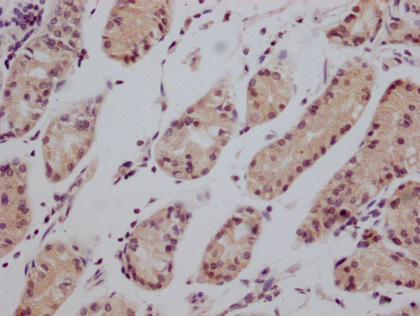 CD147 Antibody in Immunohistochemistry (Paraffin) (IHC (P))