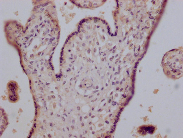 CD147 Antibody in Immunohistochemistry (Paraffin) (IHC (P))