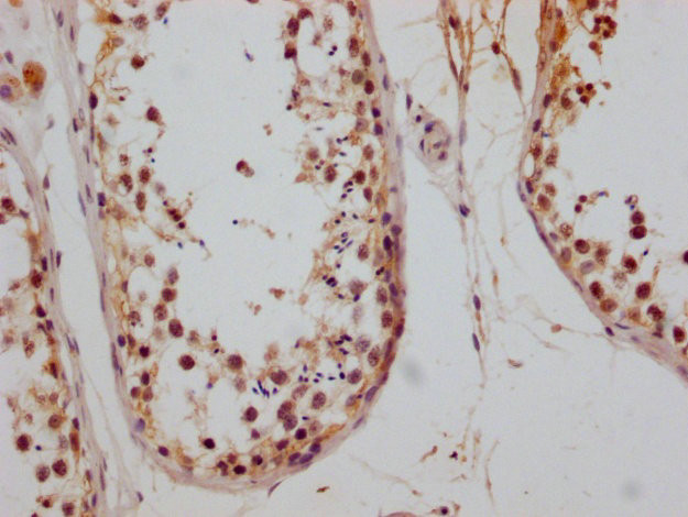 CD147 Antibody in Immunohistochemistry (Paraffin) (IHC (P))