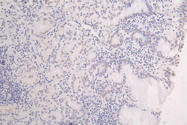 H3K27M Antibody in Immunohistochemistry (Paraffin) (IHC (P))