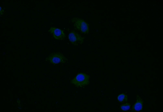 TK1 Antibody in Immunocytochemistry (ICC/IF)