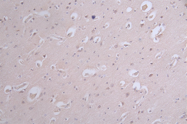 Phospho-Tau (Ser214) Antibody in Immunohistochemistry (Paraffin) (IHC (P))