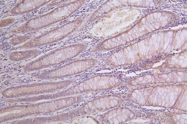 alpha Galactosidase Antibody in Immunohistochemistry (Paraffin) (IHC (P))