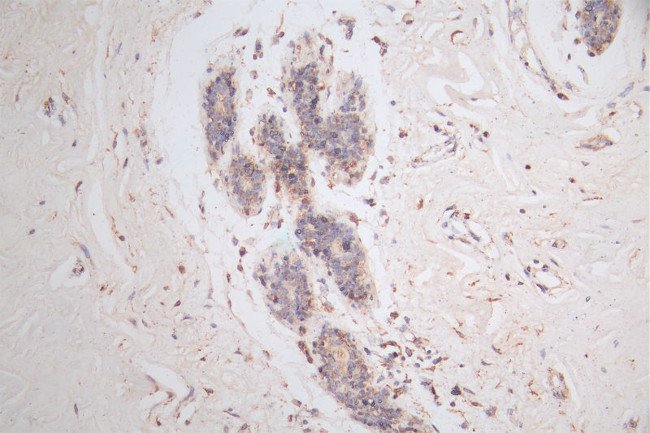 GAA Antibody in Immunohistochemistry (Paraffin) (IHC (P))