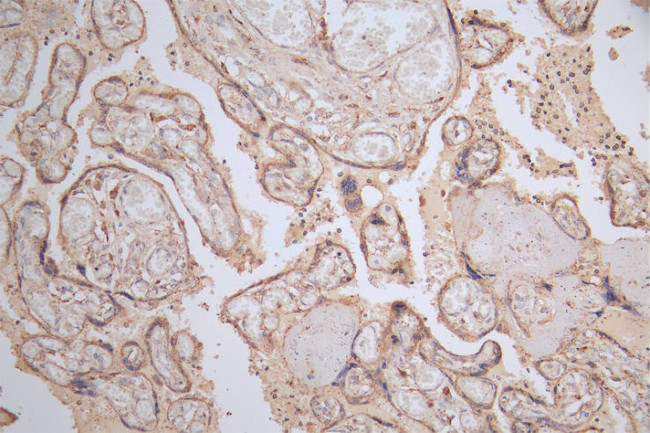 GAA Antibody in Immunohistochemistry (Paraffin) (IHC (P))