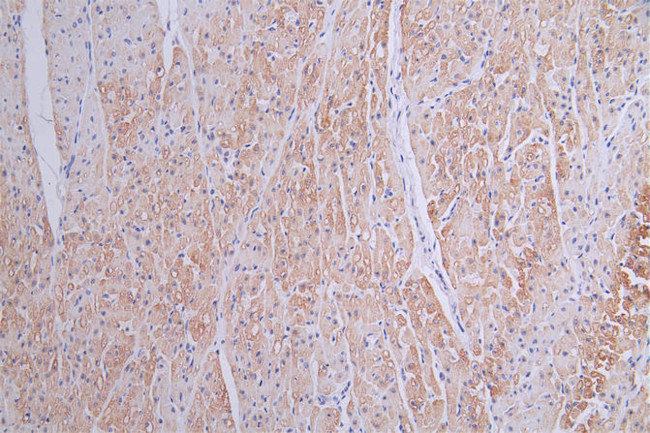 Cardiac Troponin T Antibody in Immunohistochemistry (Paraffin) (IHC (P))