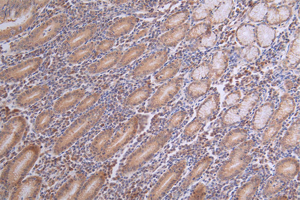 Caspase 3 Antibody in Immunohistochemistry (Paraffin) (IHC (P))