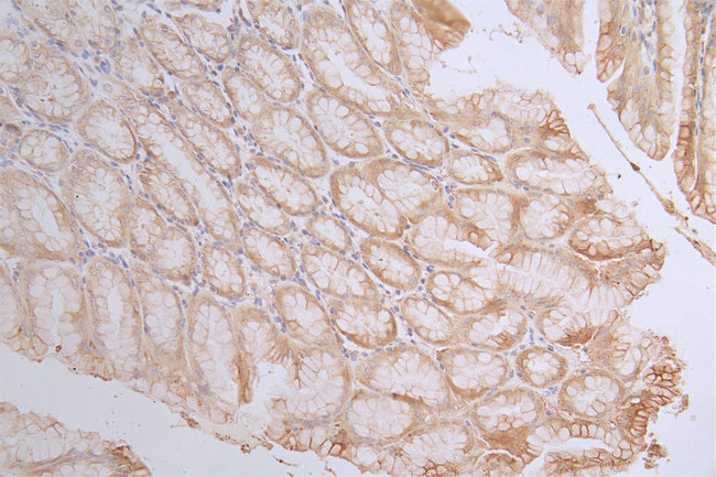 Caspase 3 Antibody in Immunohistochemistry (Paraffin) (IHC (P))