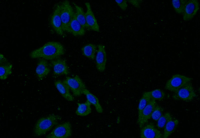 GLUT2 Antibody in Immunocytochemistry (ICC/IF)