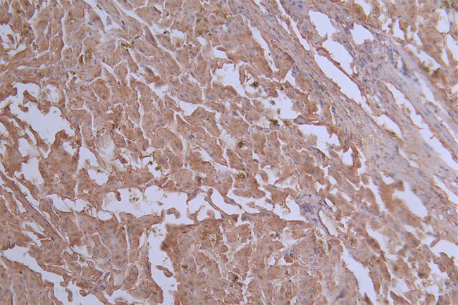 GLUT2 Antibody in Immunohistochemistry (Paraffin) (IHC (P))