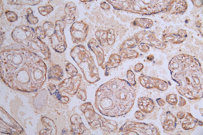 VEGF Receptor 1 Antibody in Immunohistochemistry (Paraffin) (IHC (P))