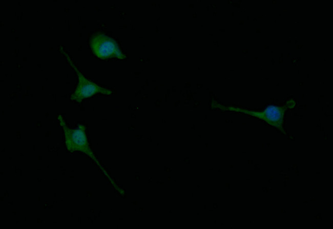 ChAT Antibody in Immunocytochemistry (ICC/IF)