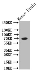 ChAT Antibody in Western Blot (WB)