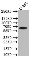 GLT-1 Antibody in Western Blot (WB)