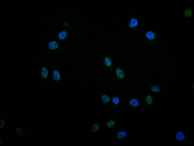 Phospho-ErbB2 (HER-2) (Tyr1139) Antibody in Immunocytochemistry (ICC/IF)
