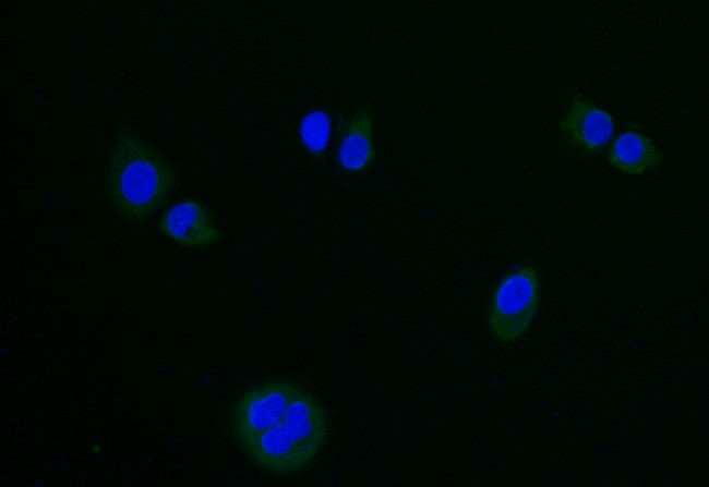 LGR6 Antibody in Immunocytochemistry (ICC/IF)