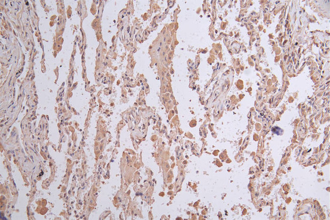 LGR6 Antibody in Immunohistochemistry (Paraffin) (IHC (P))