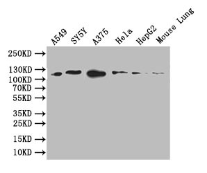 DDR2 Antibody in Western Blot (WB)