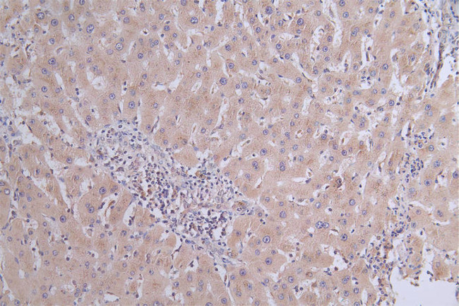 Periostin Antibody in Immunohistochemistry (Paraffin) (IHC (P))