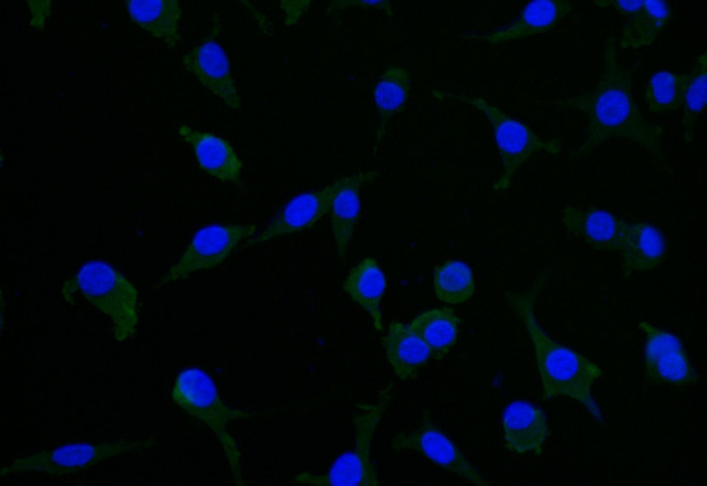 CRMP2 Antibody in Immunocytochemistry (ICC/IF)