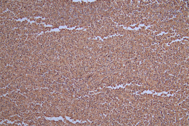 Carbonic Anhydrase I Antibody in Immunohistochemistry (Paraffin) (IHC (P))