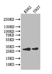 Carbonic Anhydrase I Antibody in Western Blot (WB)