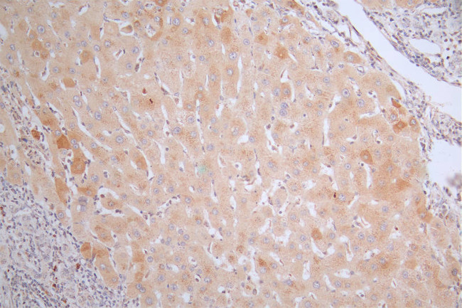 CRP Antibody in Immunohistochemistry (Paraffin) (IHC (P))