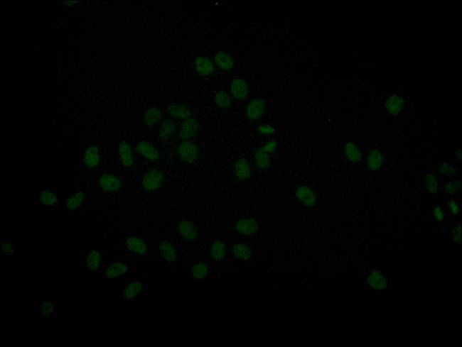 BRG1 Antibody in Immunocytochemistry (ICC/IF)