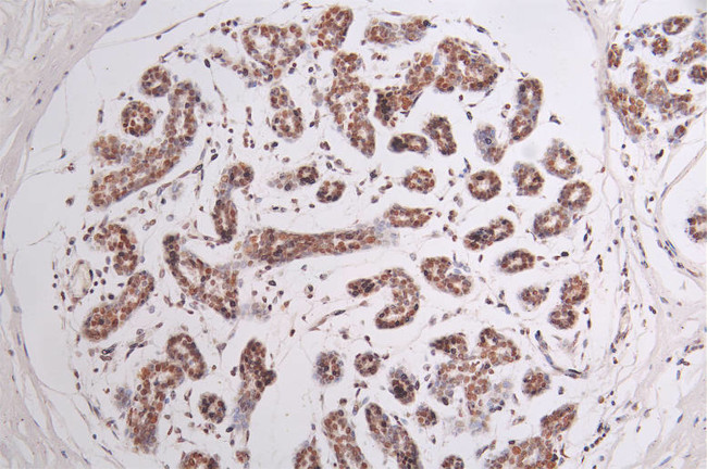 BRG1 Antibody in Immunohistochemistry (Paraffin) (IHC (P))