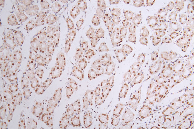 BRG1 Antibody in Immunohistochemistry (Paraffin) (IHC (P))