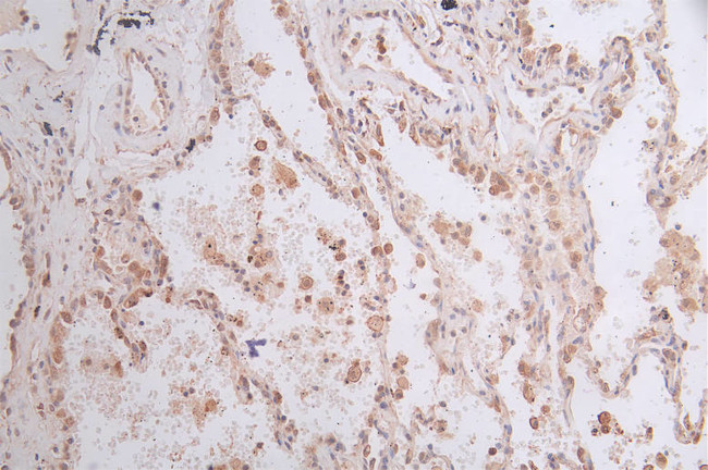 GPI Antibody in Immunohistochemistry (Paraffin) (IHC (P))