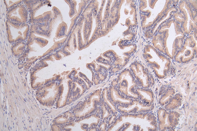 GPI Antibody in Immunohistochemistry (Paraffin) (IHC (P))