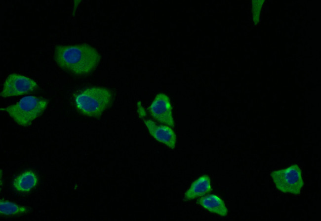 PRKAR2A Antibody in Immunocytochemistry (ICC/IF)