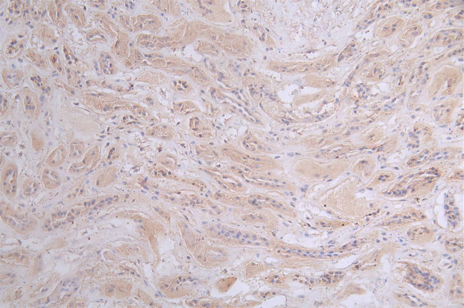 PRKAR2A Antibody in Immunohistochemistry (Paraffin) (IHC (P))