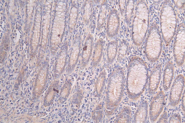 PRKAR2A Antibody in Immunohistochemistry (Paraffin) (IHC (P))