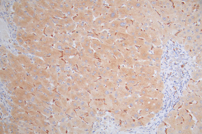 MICA Antibody in Immunohistochemistry (Paraffin) (IHC (P))