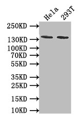 PKN2 Antibody in Western Blot (WB)