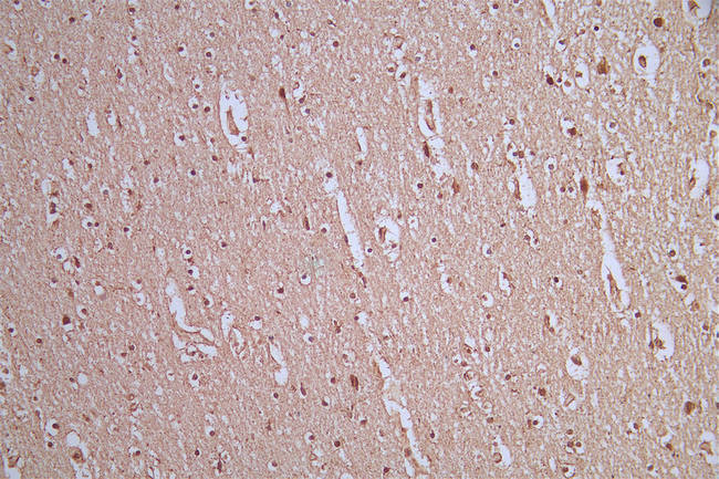 AKT Pan Antibody in Immunohistochemistry (Paraffin) (IHC (P))