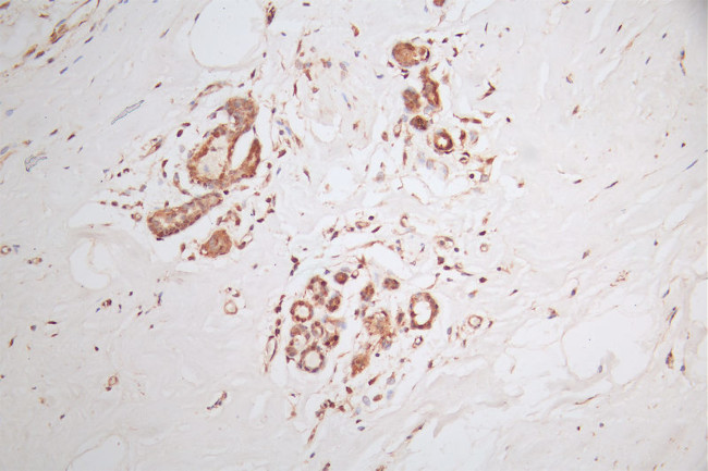 DYNLL1 Antibody in Immunohistochemistry (Paraffin) (IHC (P))