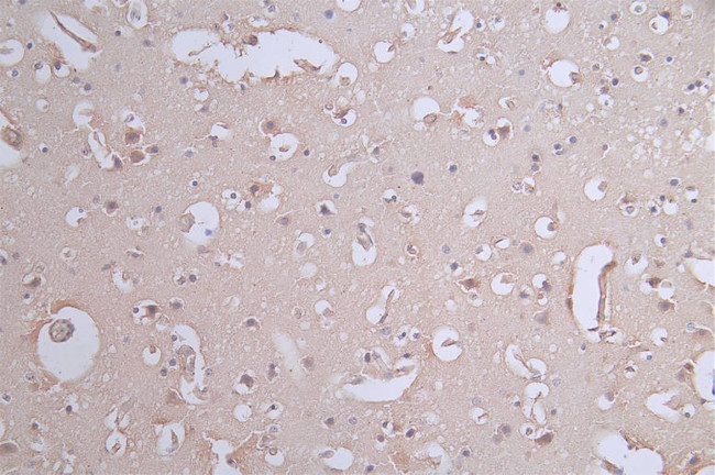 Paxillin Antibody in Immunohistochemistry (Paraffin) (IHC (P))