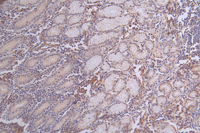 Paxillin Antibody in Immunohistochemistry (Paraffin) (IHC (P))