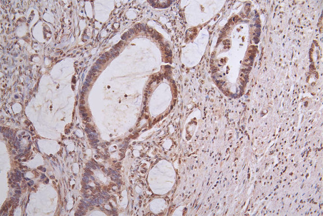 PI3K p85 alpha Antibody in Immunohistochemistry (Paraffin) (IHC (P))