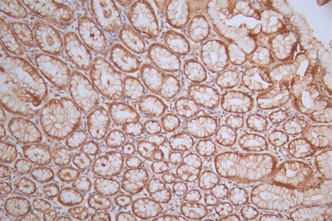 ERK1/ERK2 Antibody in Immunohistochemistry (Paraffin) (IHC (P))