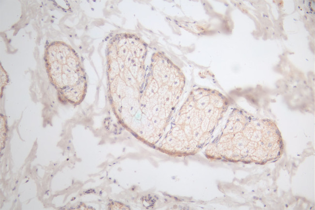 EGF Antibody in Immunohistochemistry (Paraffin) (IHC (P))