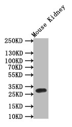 TPSB2 Antibody in Western Blot (WB)