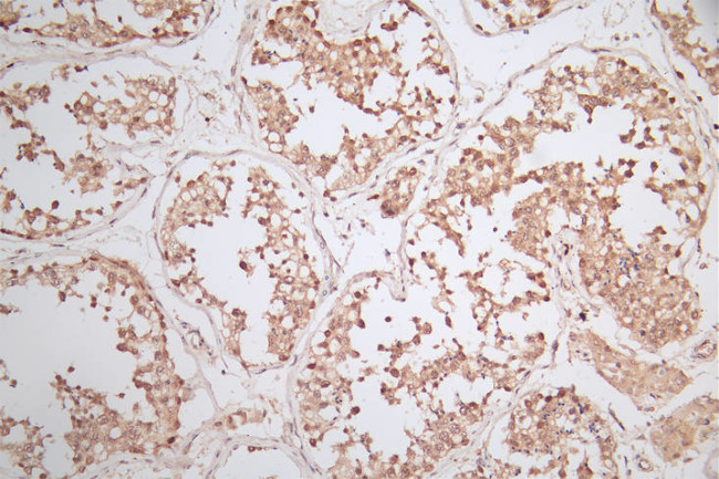 WDR5 Antibody in Immunohistochemistry (Paraffin) (IHC (P))